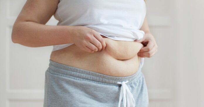 Nadváha a obezita u žen