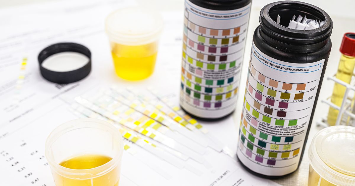 keto diéta — testovacie pásiky na meranie ketózy v moči